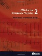 ecgs for the emergency physician