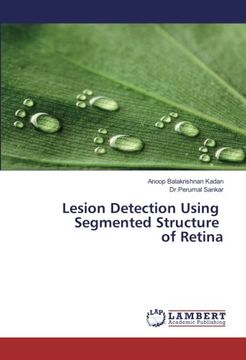 portada Lesion Detection Using Segmented Structure of Retina