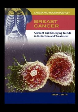 portada Breast Cancer: Current and Emerging Trends in Detection and Treatment (en Inglés)