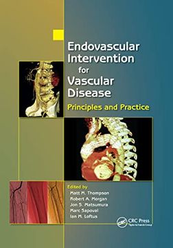 portada Endovascular Intervention for Vascular Disease: Principles and Practice (en Inglés)