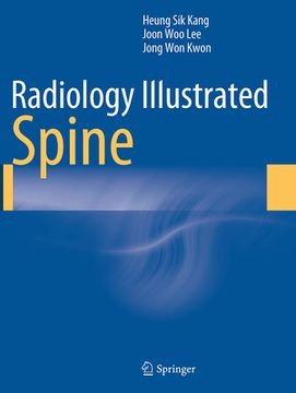 portada Radiology Illustrated: Spine (en Inglés)