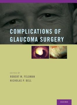 portada complications of glaucoma surgery (en Inglés)
