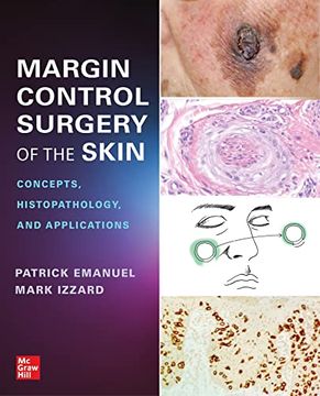 portada Margin Control Surgery of the Skin: Concepts, Histopathology, and Applications (en Inglés)