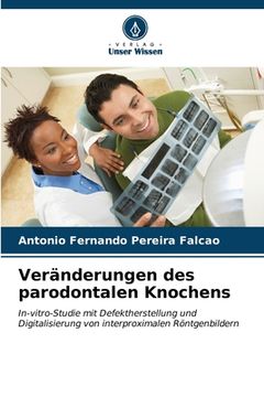 portada Veränderungen des parodontalen Knochens (en Alemán)