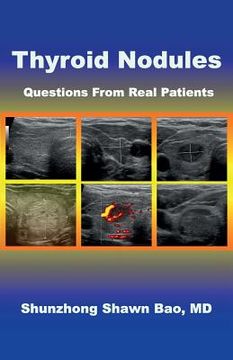 portada Thyroid Nodules: Questions From Real Patients (en Inglés)