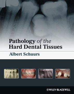 portada pathology of the hard dental tissues