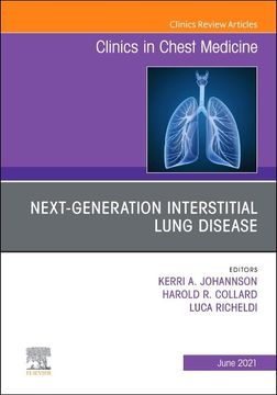 portada Next-Generation Interstitial Lung Disease, an Issue of Clinics in Chest Medicine (Volume 42-2) (The Clinics: Internal Medicine, Volume 42-2) (in English)