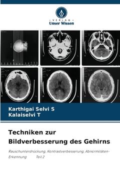 portada Techniken zur Bildverbesserung des Gehirns (in German)