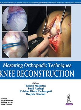 portada Mastering Orthopedic Techniques: Knee Reconstruction (en Inglés)