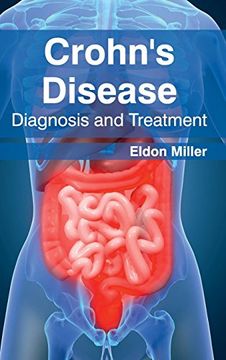 portada Crohn's Disease: Diagnosis and Treatment (in English)