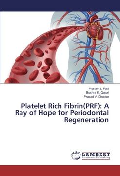 portada Platelet Rich Fibrin(PRF): A Ray of Hope for Periodontal Regeneration