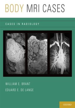 portada Body mri Cases (Cases in Radiology) (en Inglés)