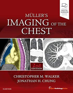 portada Muller's Imaging of the Chest: Expert Radiology Series (en Inglés)
