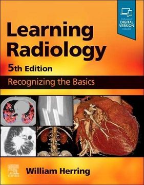 portada Learning Radiology: Recognizing the Basics (en Inglés)