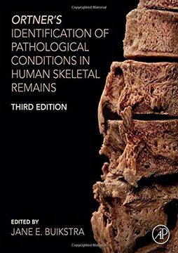 portada Ortner’S Identification of Pathological Conditions in Human Skeletal Remains (en Inglés)