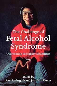 portada The Challenge of Fetal Alcohol Syndrome: Overcoming Secondary Disabilities (Jessie and John Danz Lectures) (en Inglés)