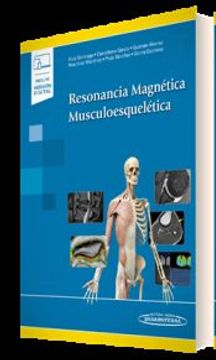 Resonancia Magnética Musculoesquelética