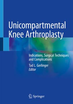 portada Unicompartmental Knee Arthroplasty: Indications, Surgical Techniques and Complications (en Inglés)