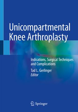 portada Unicompartmental Knee Arthroplasty: Indications, Surgical Techniques and Complications