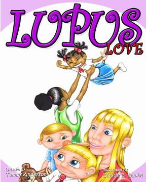 portada Lupus Love (en Inglés)