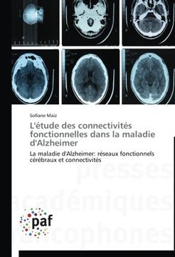 portada L'étude des connectivités fonctionnelles dans la maladie d'Alzheimer