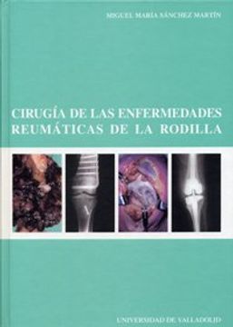 portada Cirugía de las Enfermedades Reumáticas de la Rodilla (in Spanish)