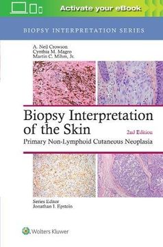 portada Biopsy Interpretation of the Skin: Primary Non-Lymphoid Cutaneous Neoplasia (Biopsy Interpretation Series) (en Inglés)