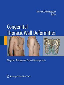 portada Congenital Thoracic Wall Deformities: Diagnosis, Therapy and Current Developments (in English)