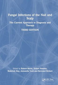 portada Fungal Infections of the Nail and Scalp: The Current Approach to Diagnosis and Therapy