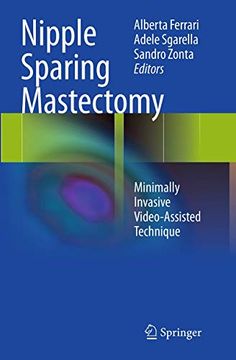 portada Nipple Sparing Mastectomy: Minimally Invasive Video-Assisted Technique (en Inglés)