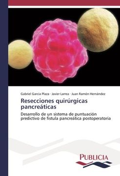 portada Resecciones quirúrgicas pancreáticas: Desarrollo de un sistema de puntuación predictivo de fistula pancreática postoperatoria
