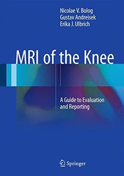 portada MRI of the Knee: A Guide to Evaluation and Reporting (in English)
