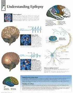 portada Understanding Epilepsy Chart: Wall Chart (en Inglés)