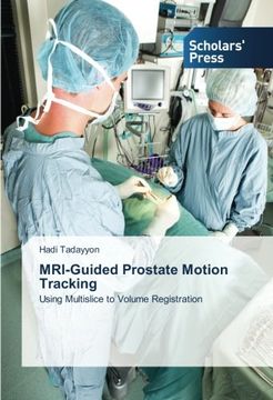 portada MRI-Guided Prostate Motion Tracking