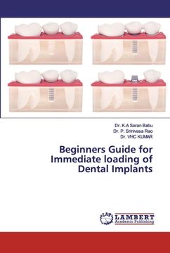 portada Beginners Guide for Immediate loading of Dental Implants (in English)