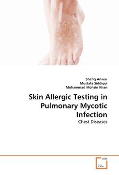 portada Skin Allergic Testing in Pulmonary Mycotic Infection: Chest Diseases
