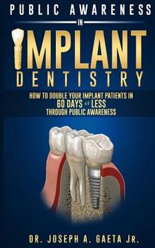 portada Public Awareness In Implant Dentistry: How To Double Your Implant Patients In 60 Days Or Less Through Public Awareness
