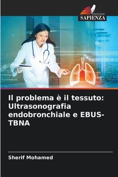 portada Il problema è il tessuto: Ultrasonografia endobronchiale e EBUS-TBNA (en Italiano)