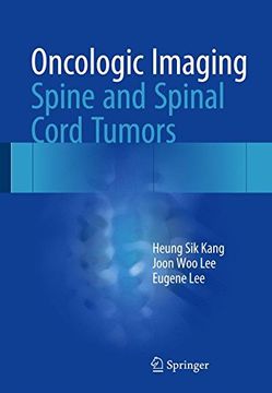 portada Oncologic Imaging: Spine and Spinal Cord Tumors