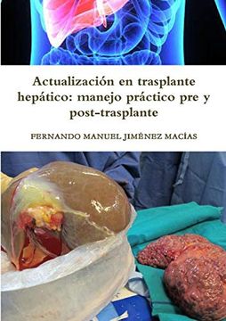 portada Actualización en Trasplante Hepático: Manejo Práctico pre y Post-Trasplante