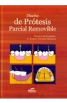 Libro Diseño De Protesis Parcial Removible 1Ed De Loza - Buscalibre