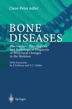 portada bone diseases (en Inglés)