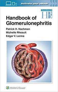 portada Handbook of Glomerulonephritis (en Inglés)