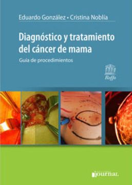 portada Diagnostico y Tratamiento del Cancer de Mama. Guia de Procedimientos