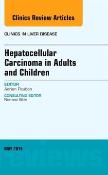 portada Hepatocellular Carcinoma in Adults and Children, an Issue of Clinics in Liver Disease (Volume 19-2) (The Clinics: Internal Medicine, Volume 19-2) (in English)