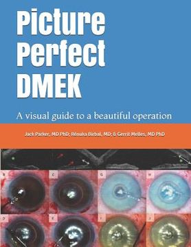 portada Picture Perfect DMEK: A visual guide to a beautiful operation (en Inglés)