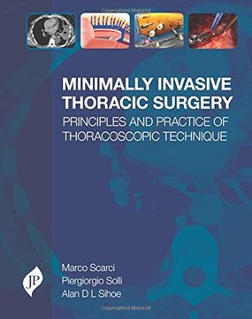 portada Minimally Invasive Thoracic Surgery: Principles and Practice of Thoracoscopic Technique