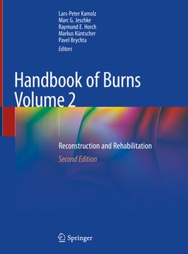 portada Handbook of Burns Volume 2: Reconstruction and Rehabilitation (en Inglés)