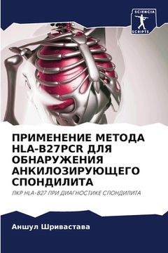 portada ПРИМЕНЕНИЕ МЕТОДА HLA-B27PCR ДЛЯ &#1 (en Ruso)