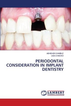 portada Periodontal Consideration in Implant Dentistry (en Inglés)